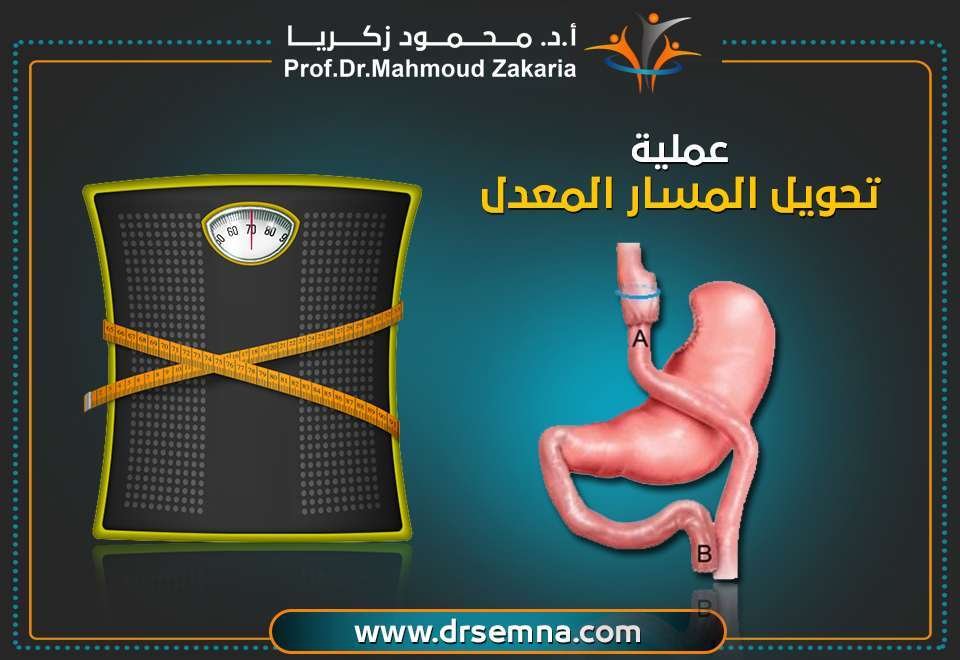 تحويل المسار المعدل