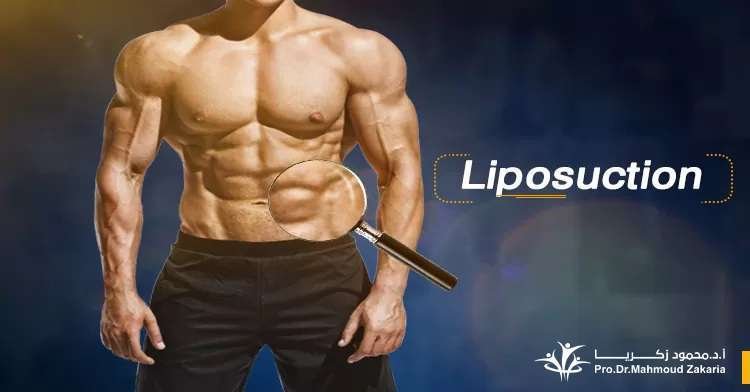 Liposuction and body contouring