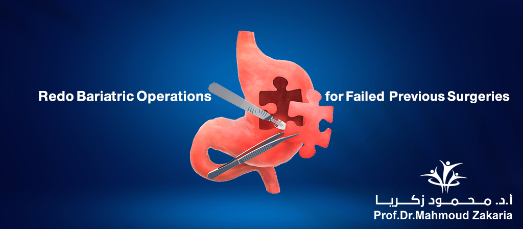 Revisional Operations
