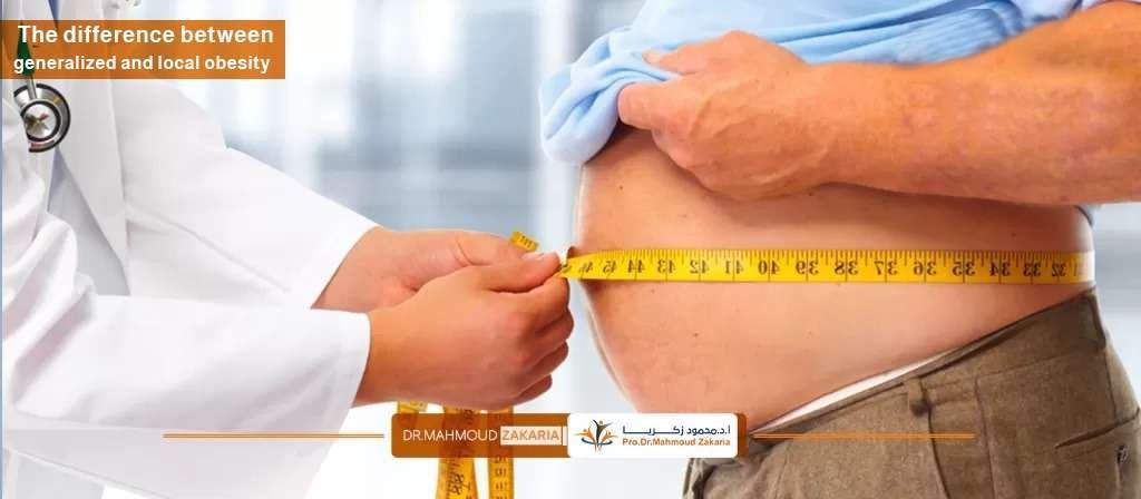 the-difference-between-generalized-local-obesity