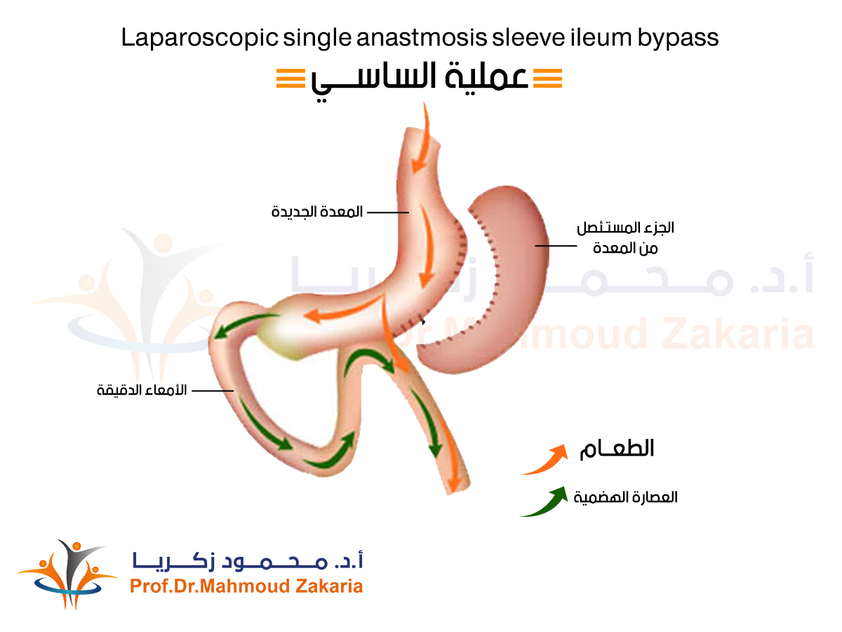 تكلفة-عملية-الساسي