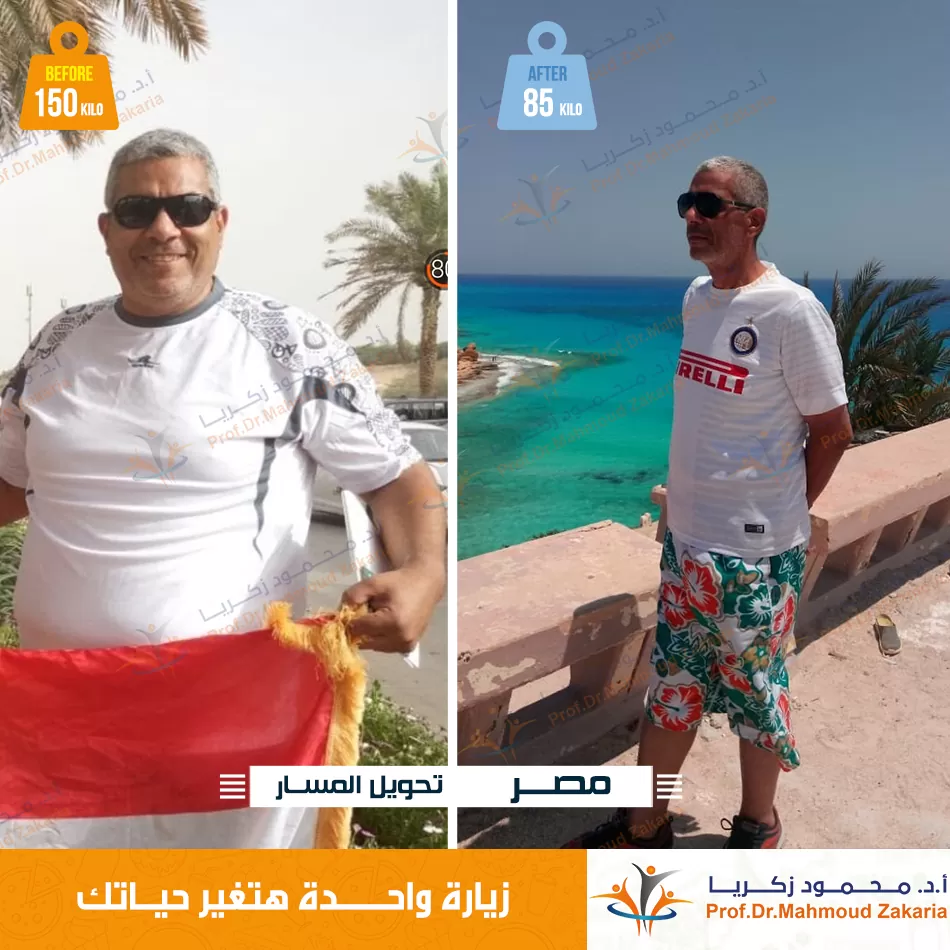 تحويل-المسار-قبل-بعد