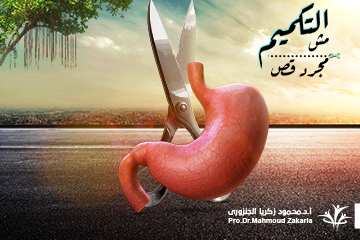 عملية-التكميم-فى-مصر