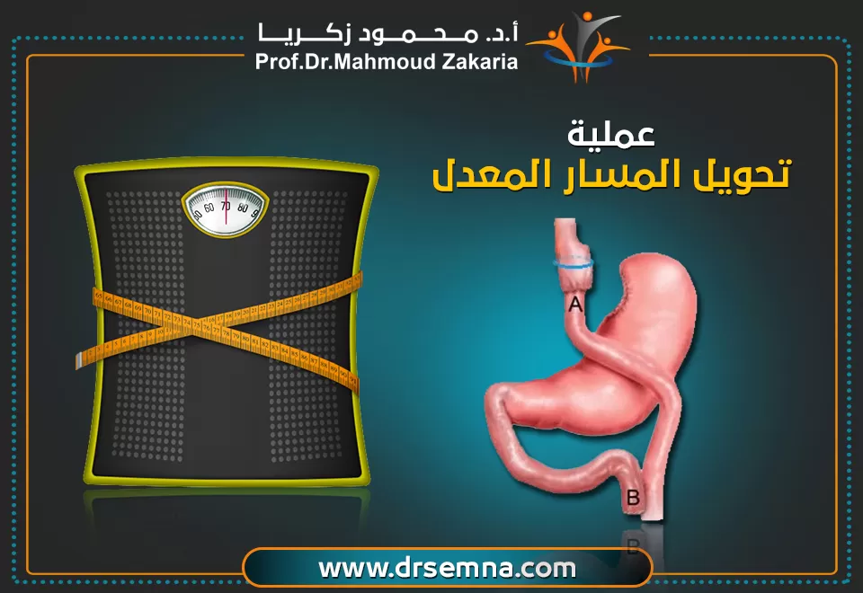 تحويل-المسار-المعدل