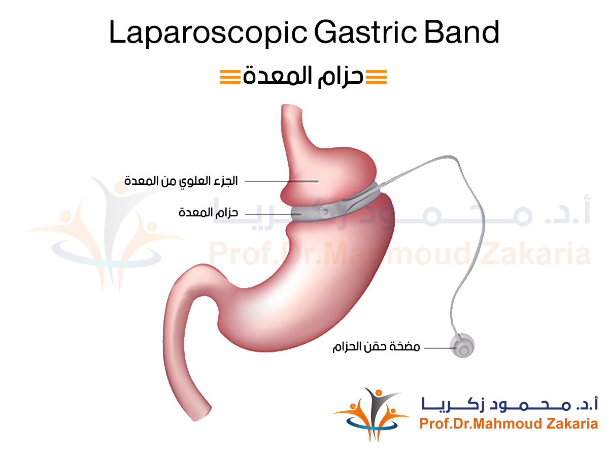 هل مازالت حزام المعدة عملية ناجحة للتخسيس؟
