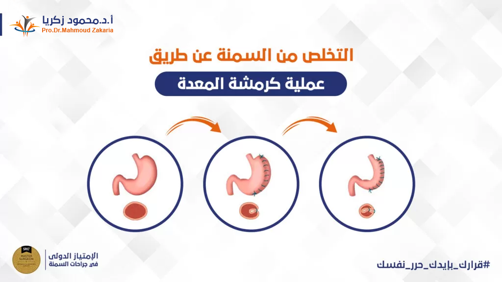فوائد-كرمشة-المعدة