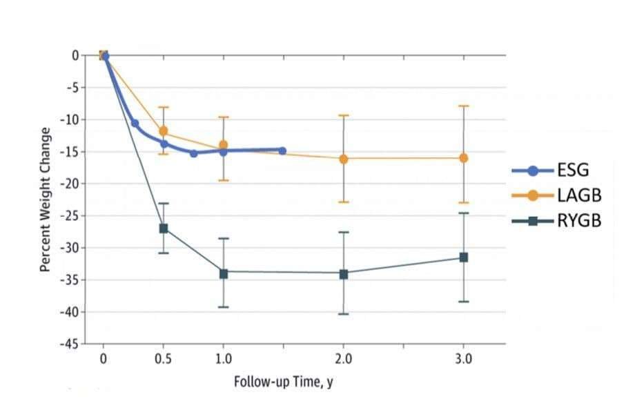 معدل-نزول-الوزن-بعملية-كشكشة-المعدة