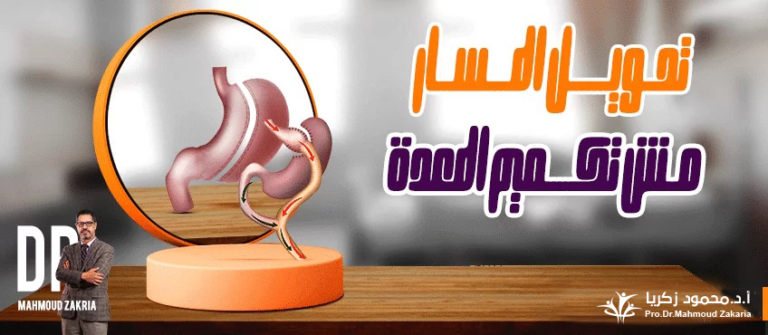 الاختلاف-بين-تكميم-المعدة-تحويل-المسار