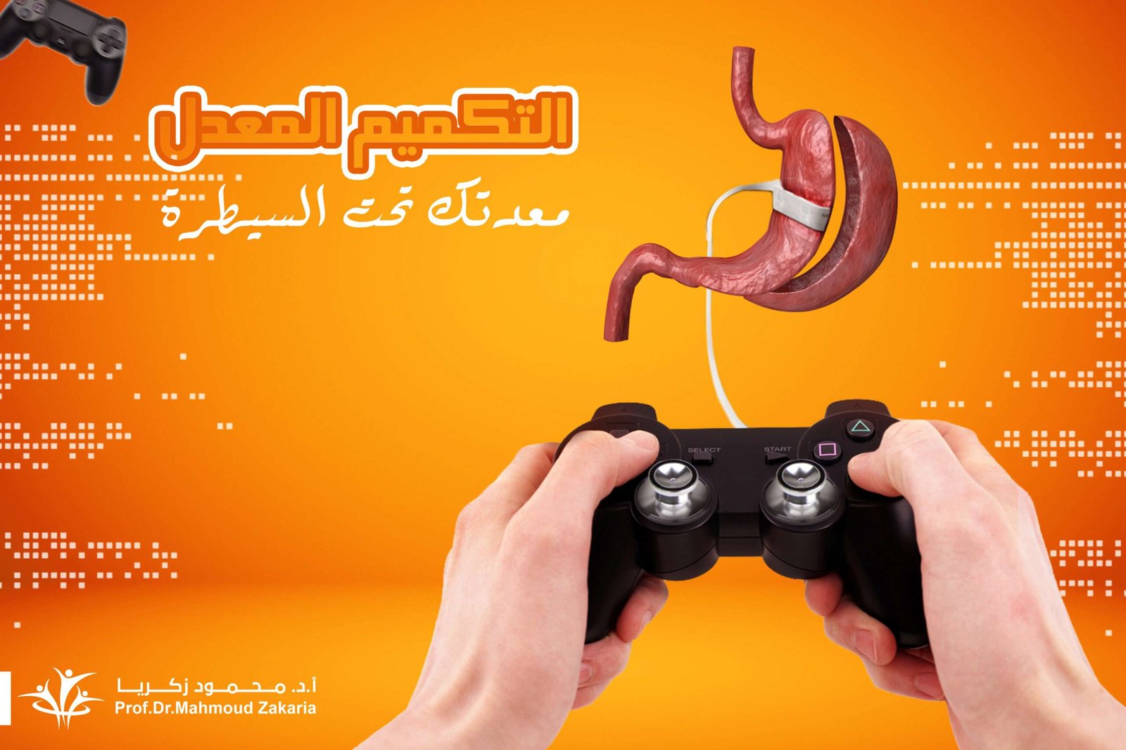 التكميم-المعدل