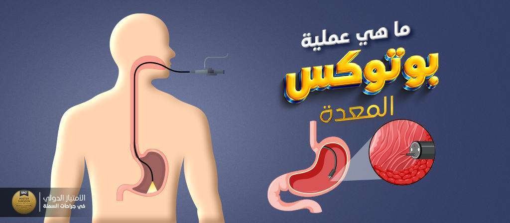 ما هى عملية بوتكس المعدة والشخص المناسب لها؟
