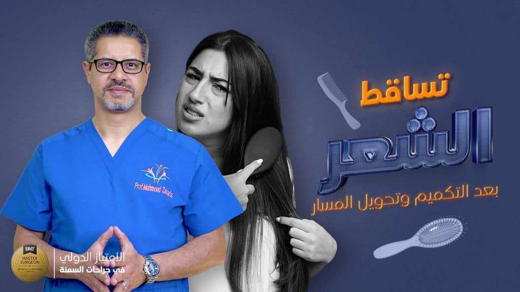 تساقط-الشعر-بعد-التكميم