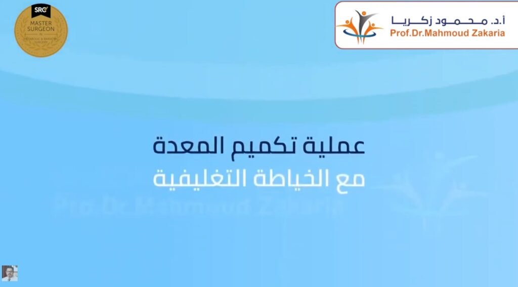الخياطة التغليفية وحزام المعدة من أهم الأساليب في مركز الدكتور محمود زكريا لأمان مرضاه