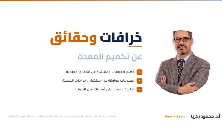 خرافات وحقائق عن تكميم المعدة
